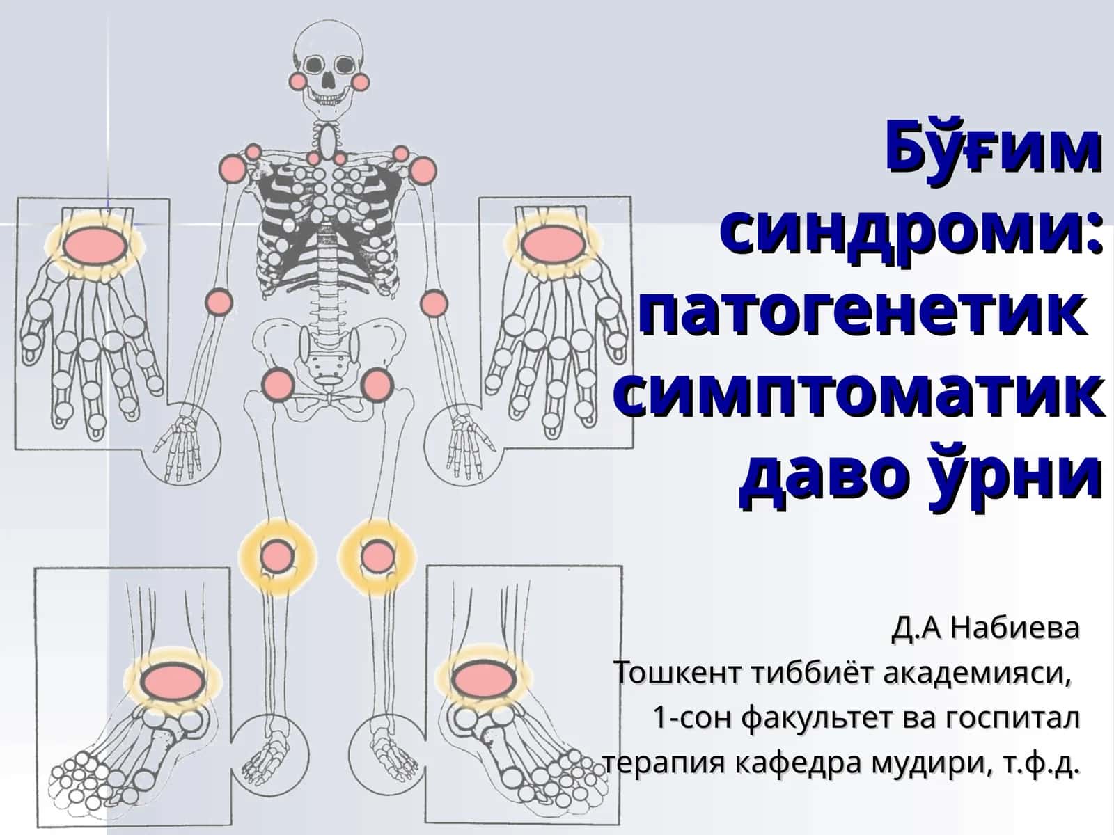 Бўғим синдроми: патогенетик симптоматик даво ўрни