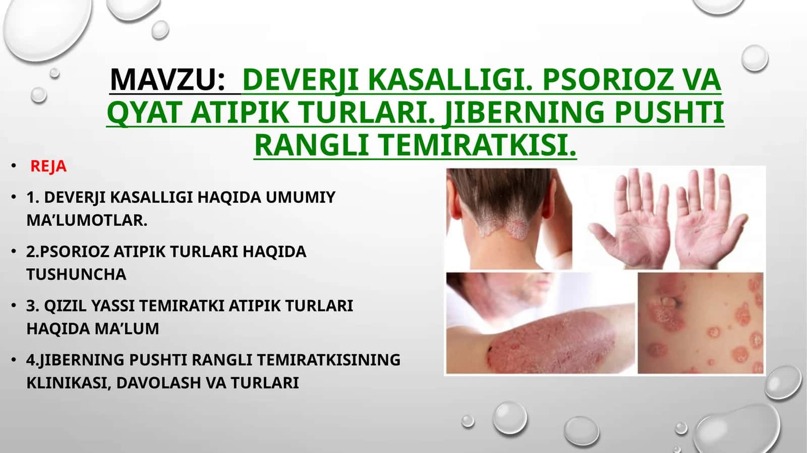 Deverji kasalligi. Psorioz va QYaT atipik turlari. Jiberning pushti rangli temiratkisi