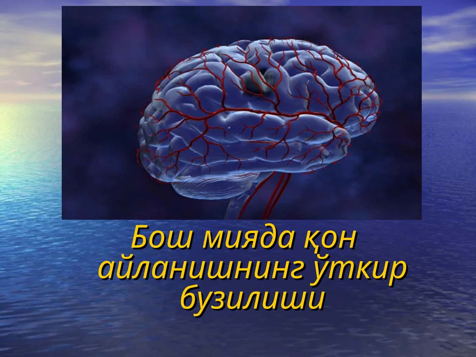 Бош миядақон айланишнинг ўткир бузилиши