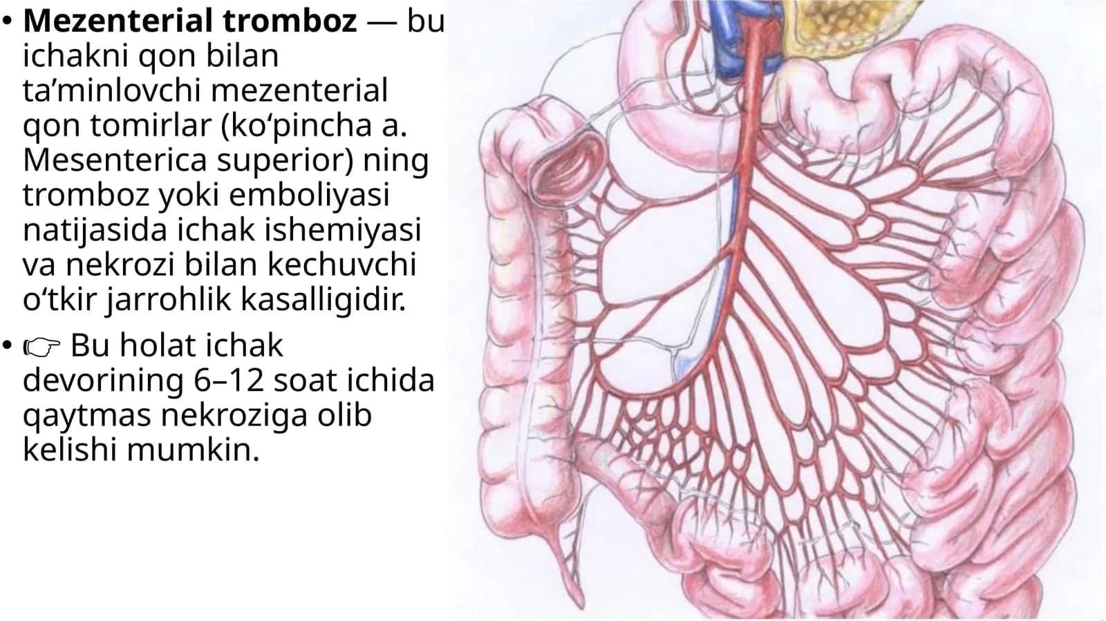 Mezenterial trombozlar