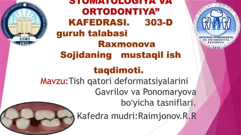 Tish qatorlari deformatsiyalari
