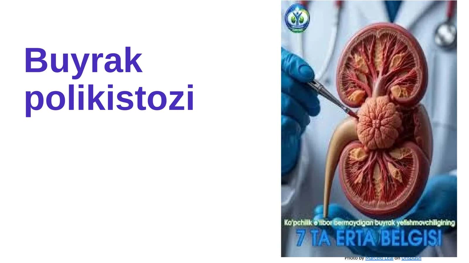 Buyrak polikistozi