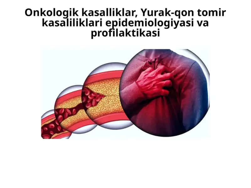 Onkologik kasalliklar: Epidemiologiya