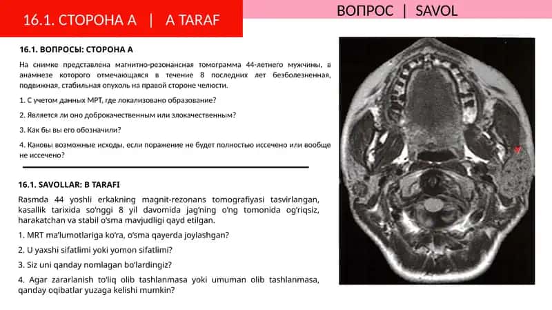 Магнитно-резонанс томограмма