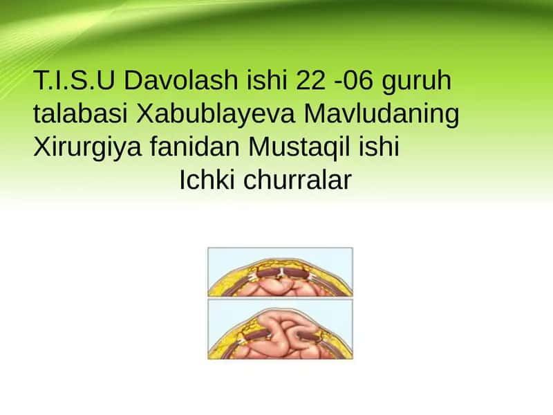 Ichki churralar