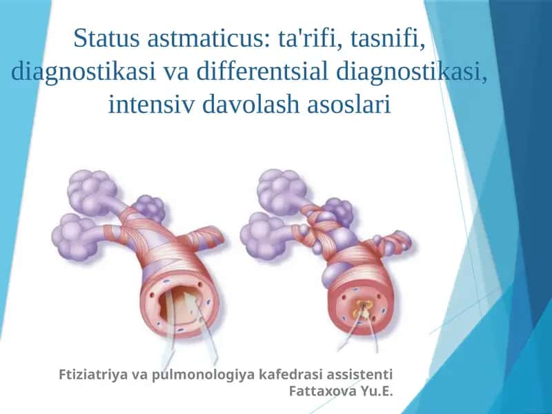 Status astmaticus: ta'rifi, tasnifi, diagnostikasi va differentsial diagnostikasi, intensiv davolash asoslari