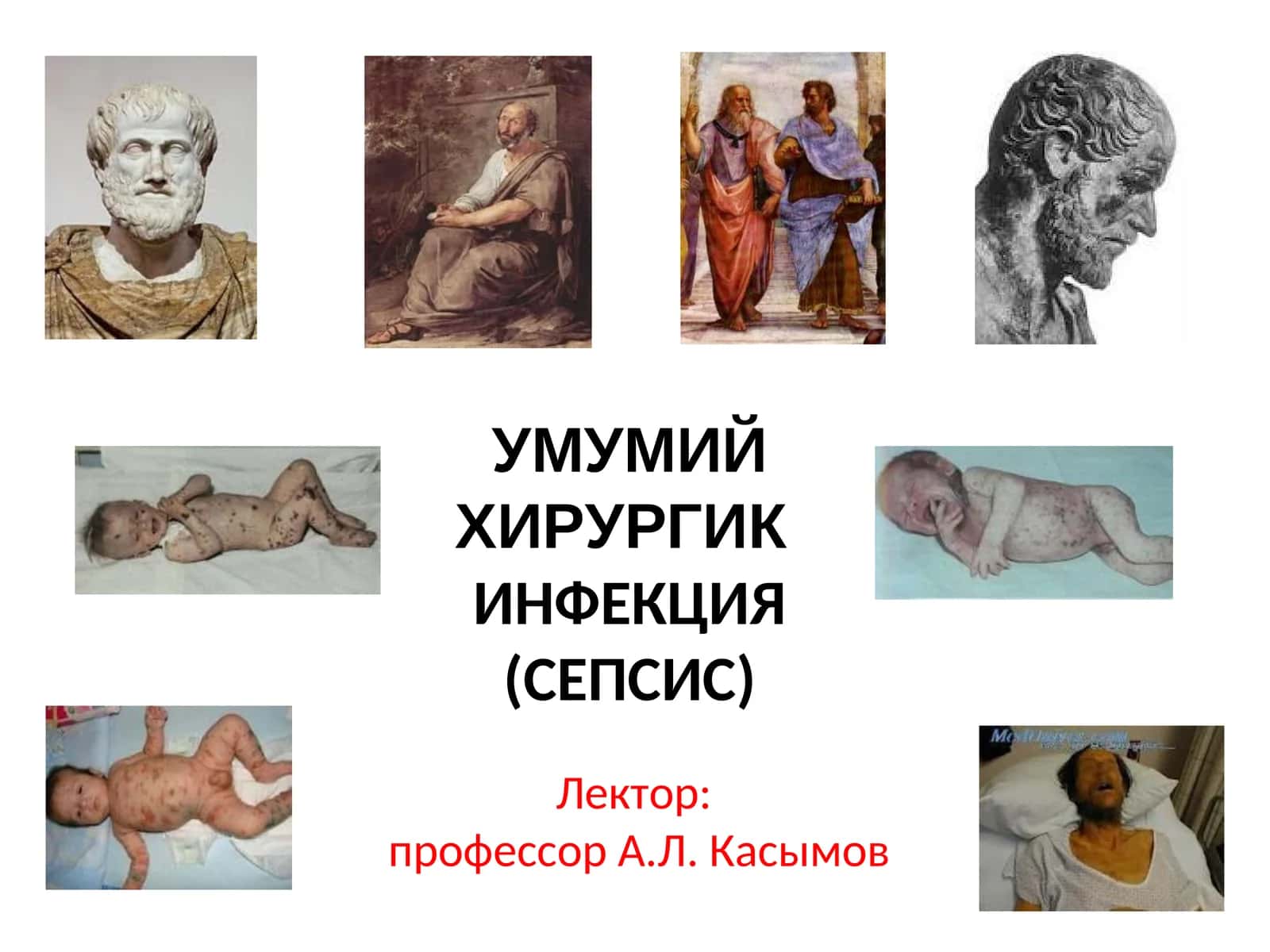УМУМИЙ ХИРУРГИКИНФЕКЦИЯ (СЕПСИС)