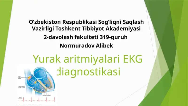 YurakaritmiyalariEKG diagnostikasi