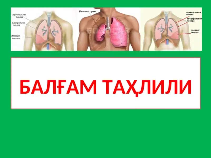 Балғам таҳлили
