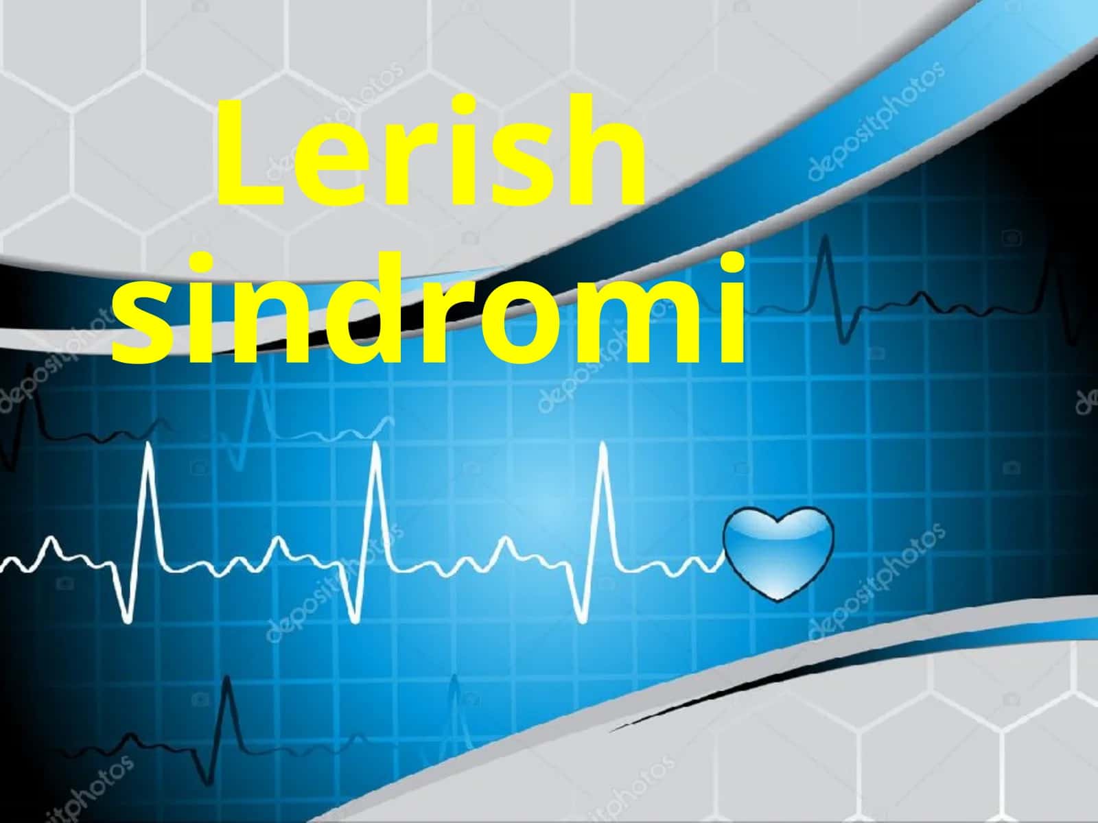 Lerishsindromi