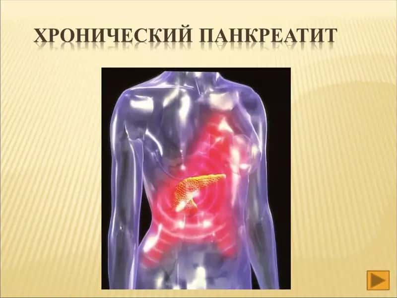 Хронического панкреатит