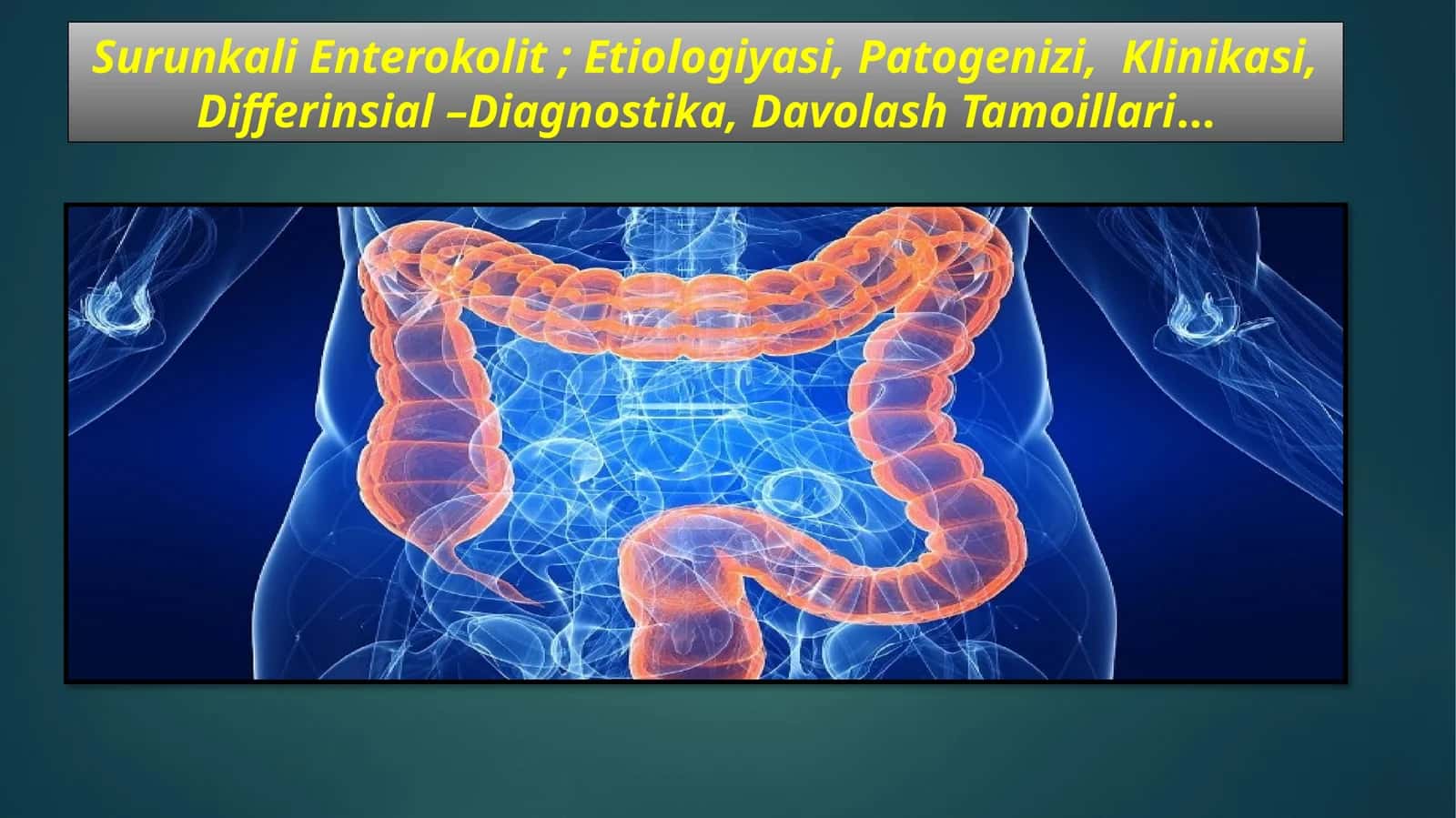 Surunkali Enterokolit;Etiologiyasi,Patogenizi,Klinikasi,Differinsial–Diagnostika,DavolashTamoillari…