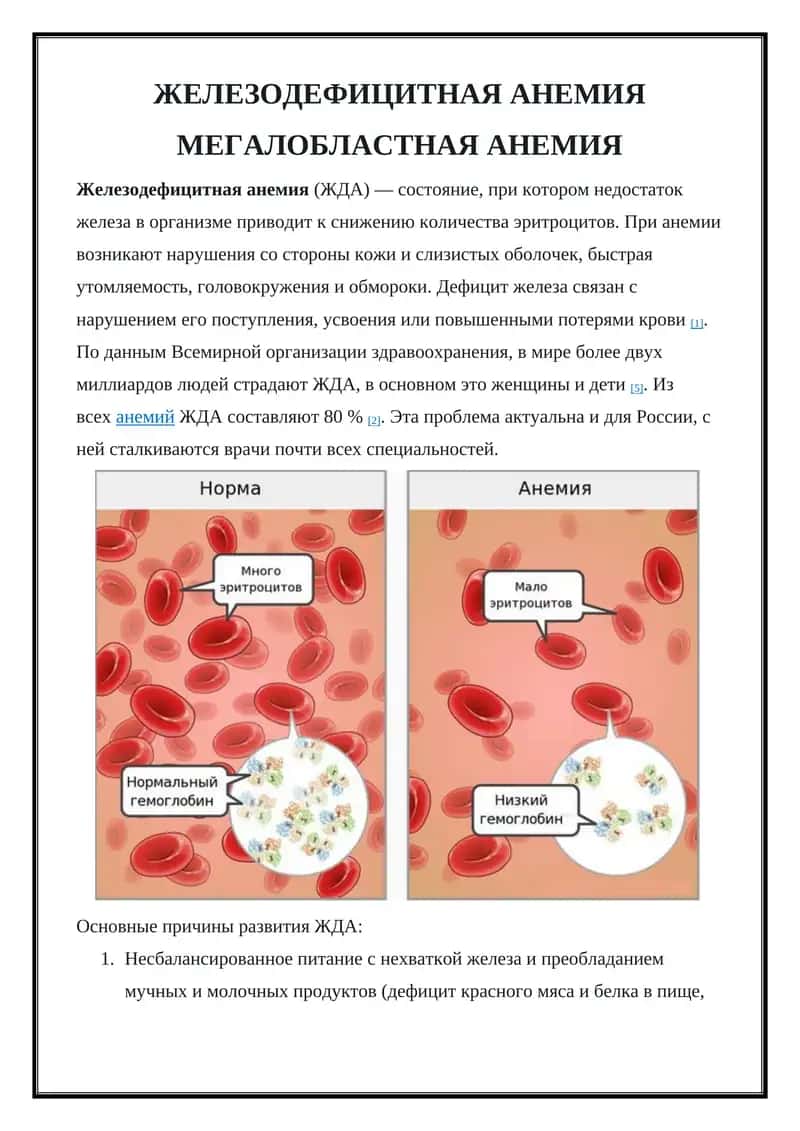 Железодефицитная анемия