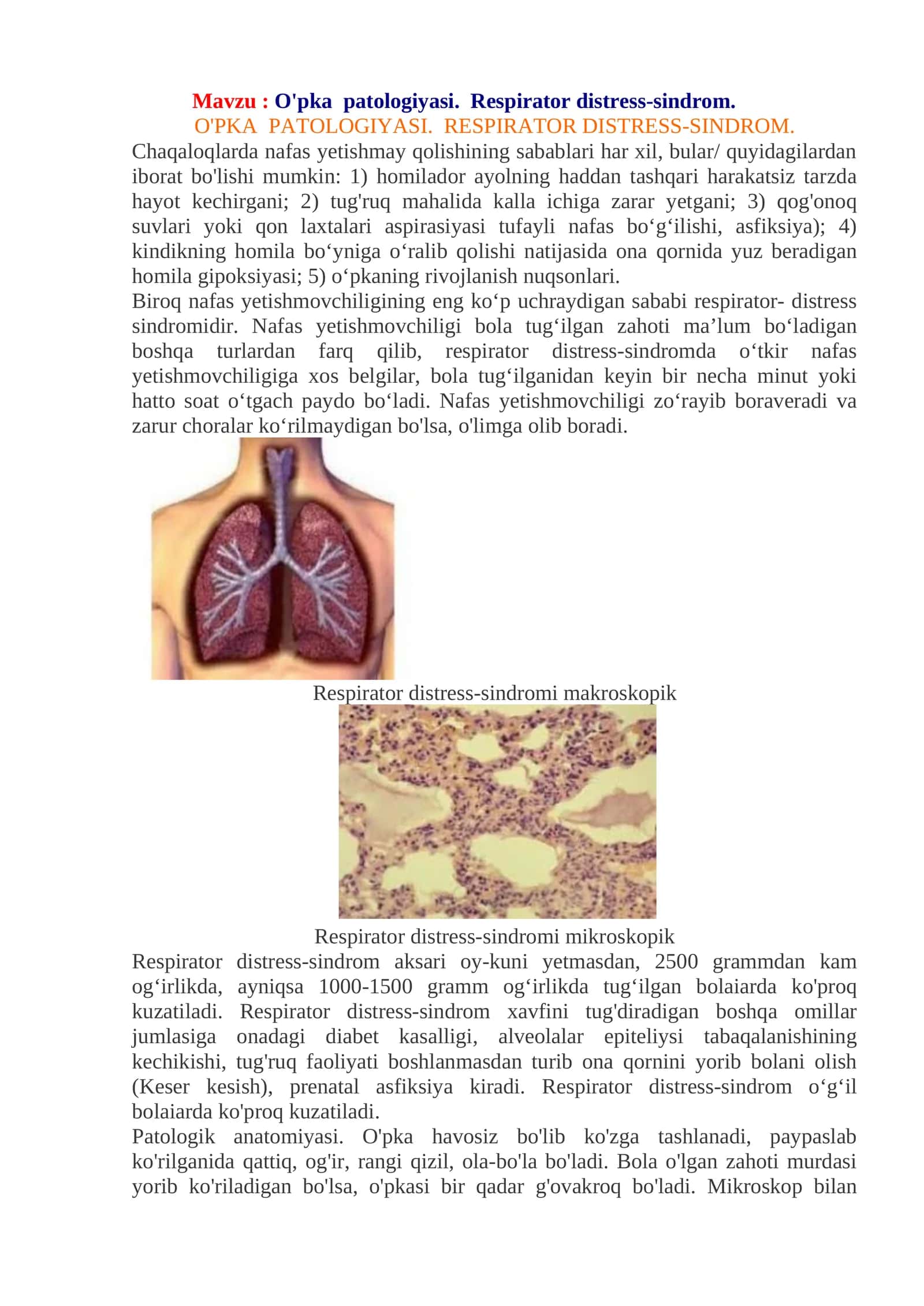 O'pka patologiyasi. Respirator distress-sindrom