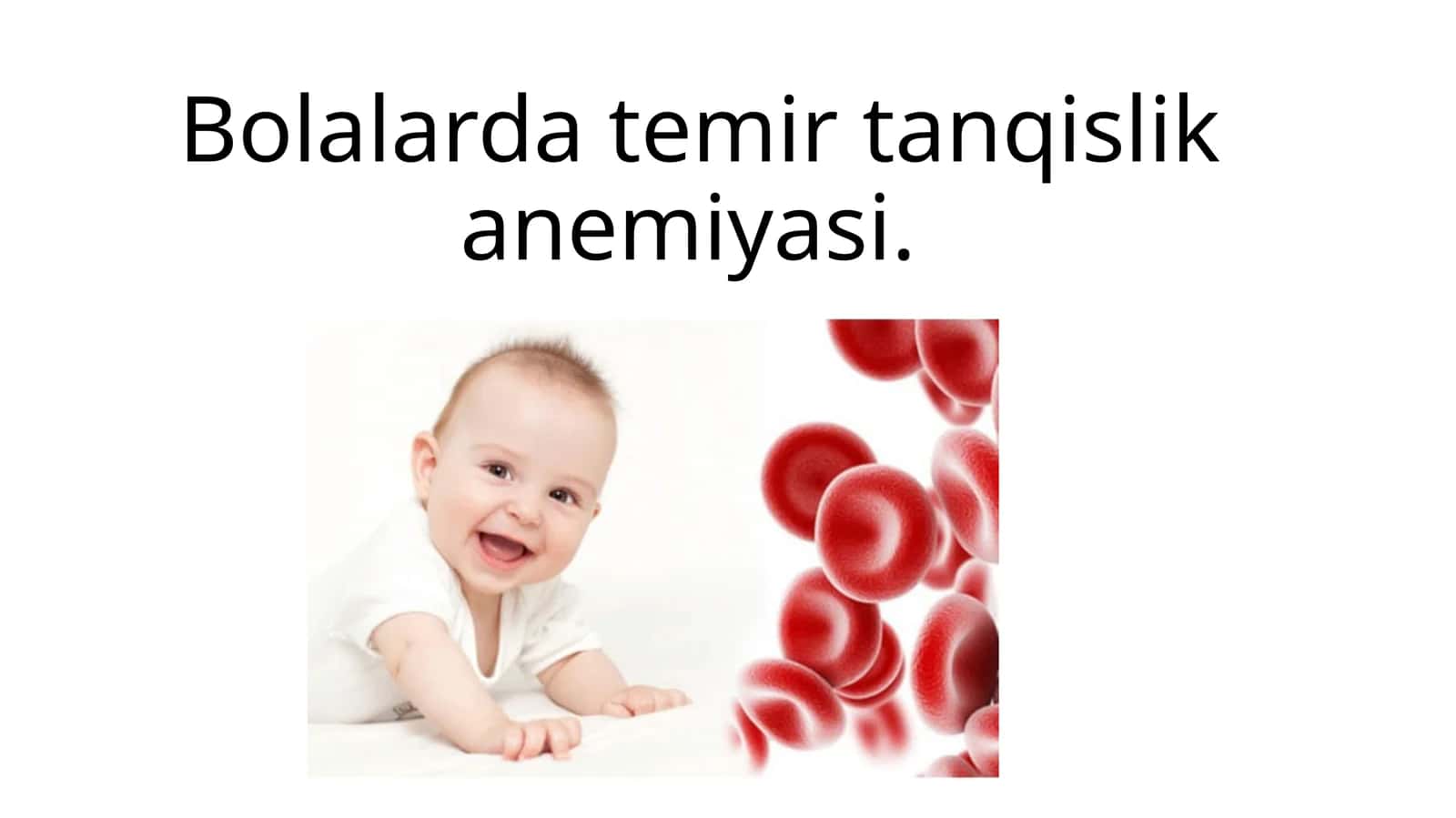 bolalarda temir tanqislik anemiyasi