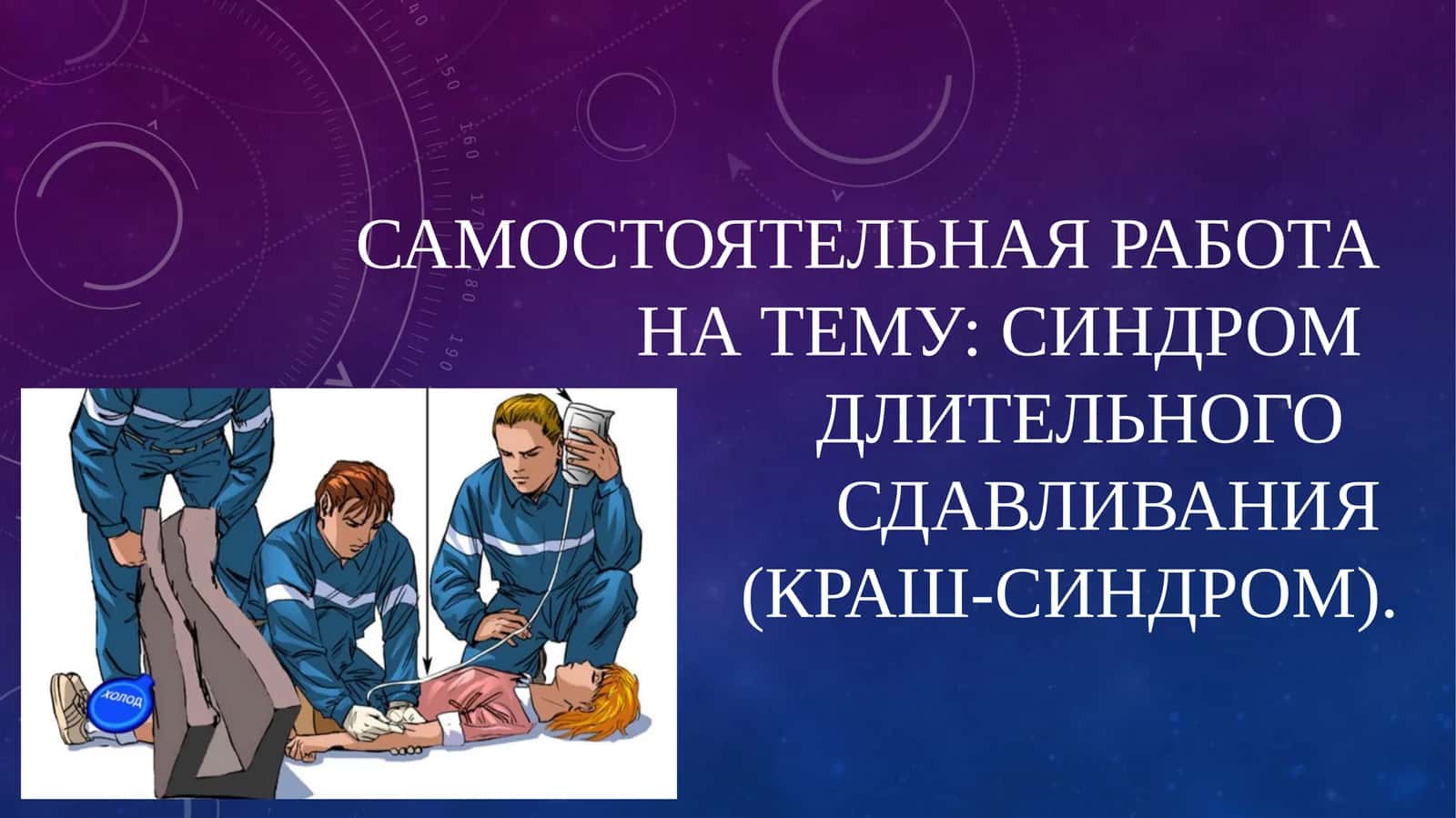 Синдром длительного сдавления (СДС)