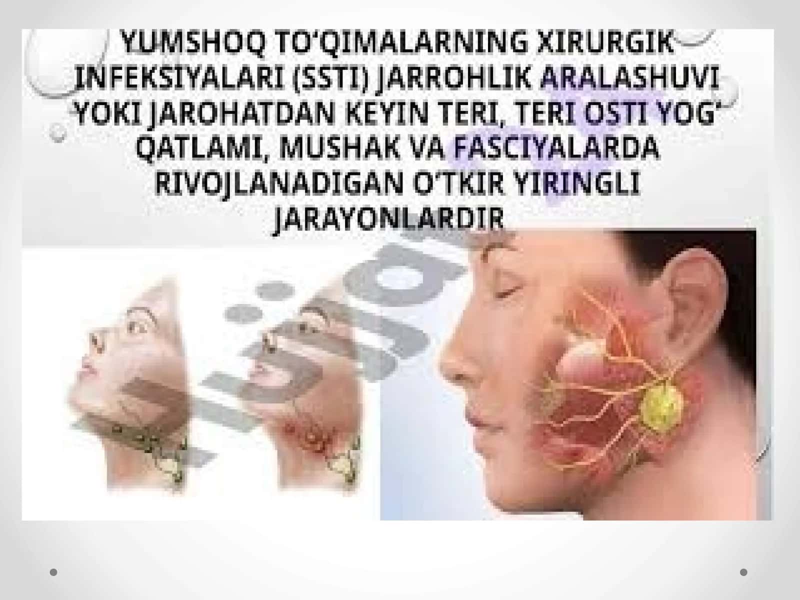 Yumshoq to'qimalarning xirurgik infeksiyasi