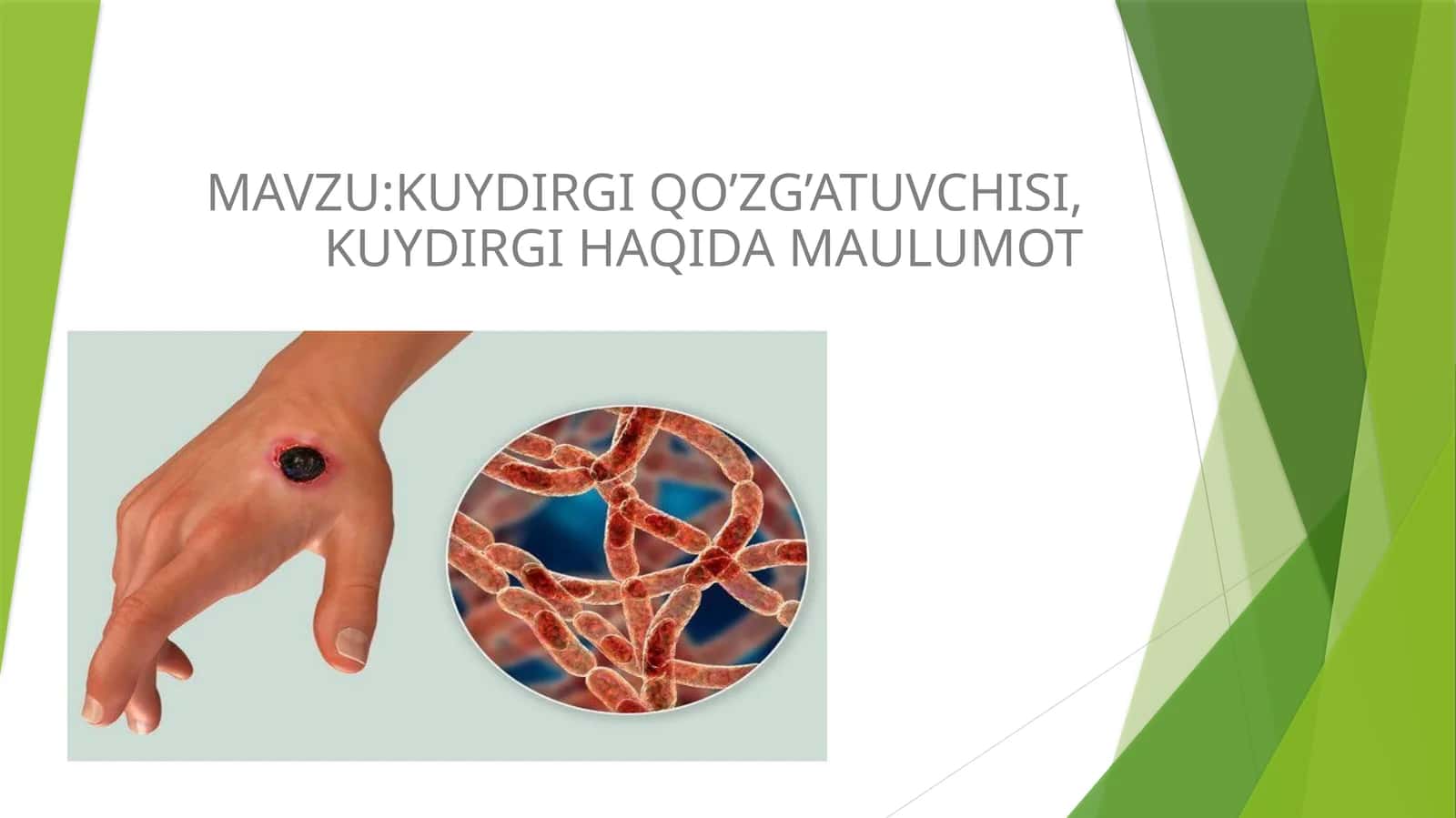 KUYDIRGI QO’ZG’ATUVCHISI, KUYDIRGI HAQIDA MA‘LUMOT