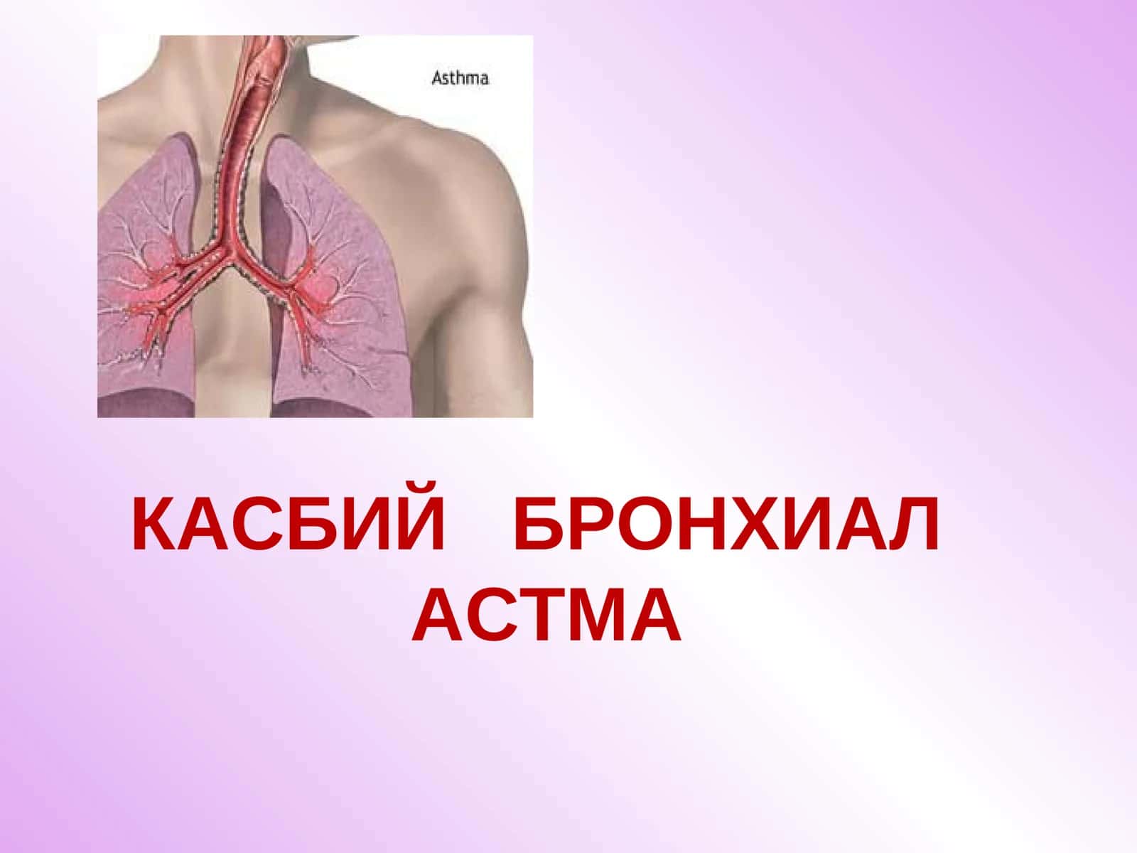 КАСБИЙ БРОНХИАЛ АСТМА