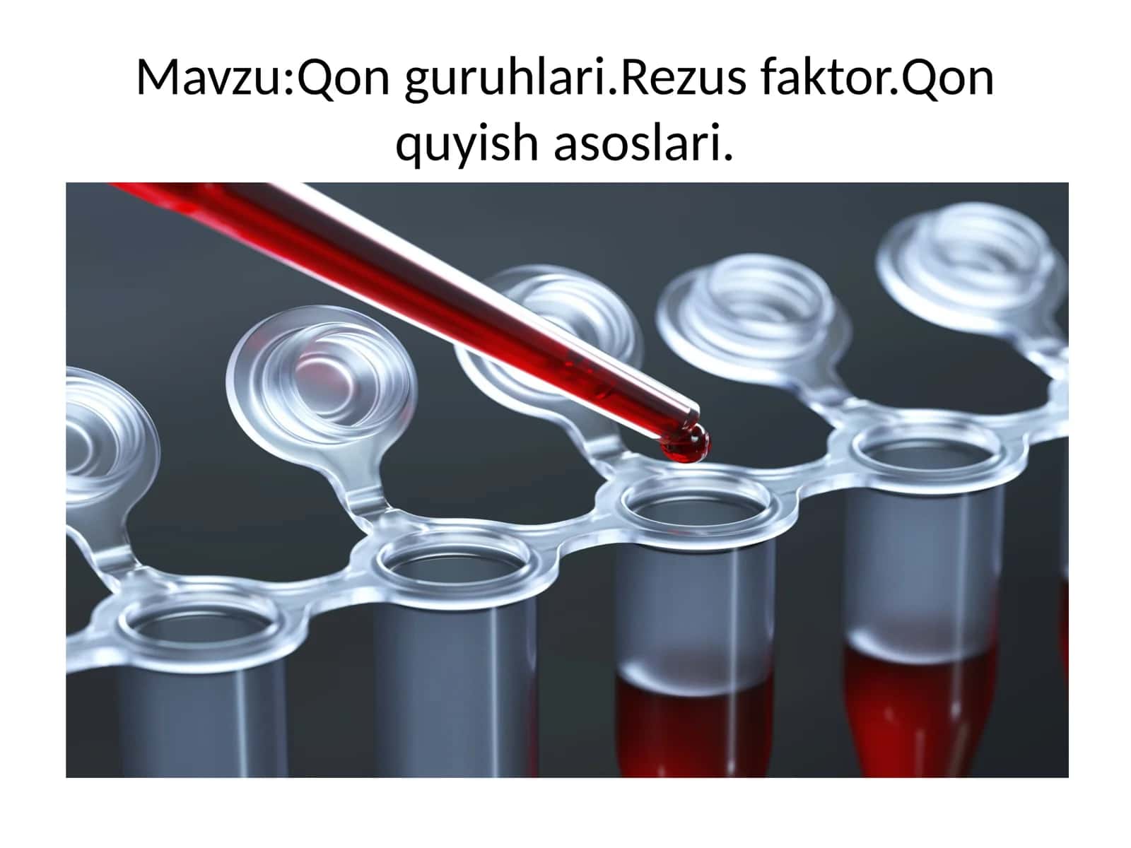 Qonguruhlari.Rezusfaktor.Qonquyishasoslari