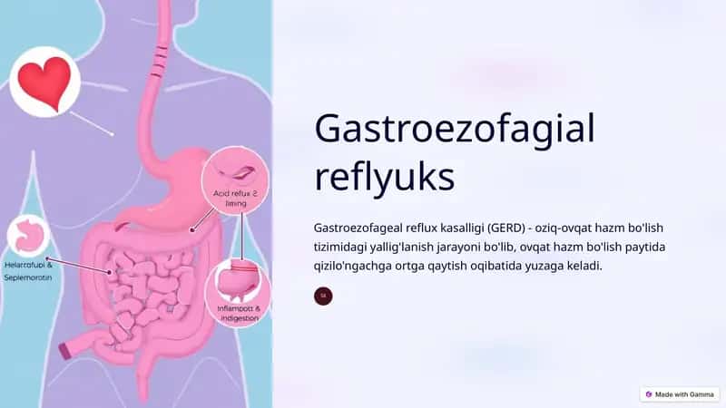 Gastroezofagial reflyuks