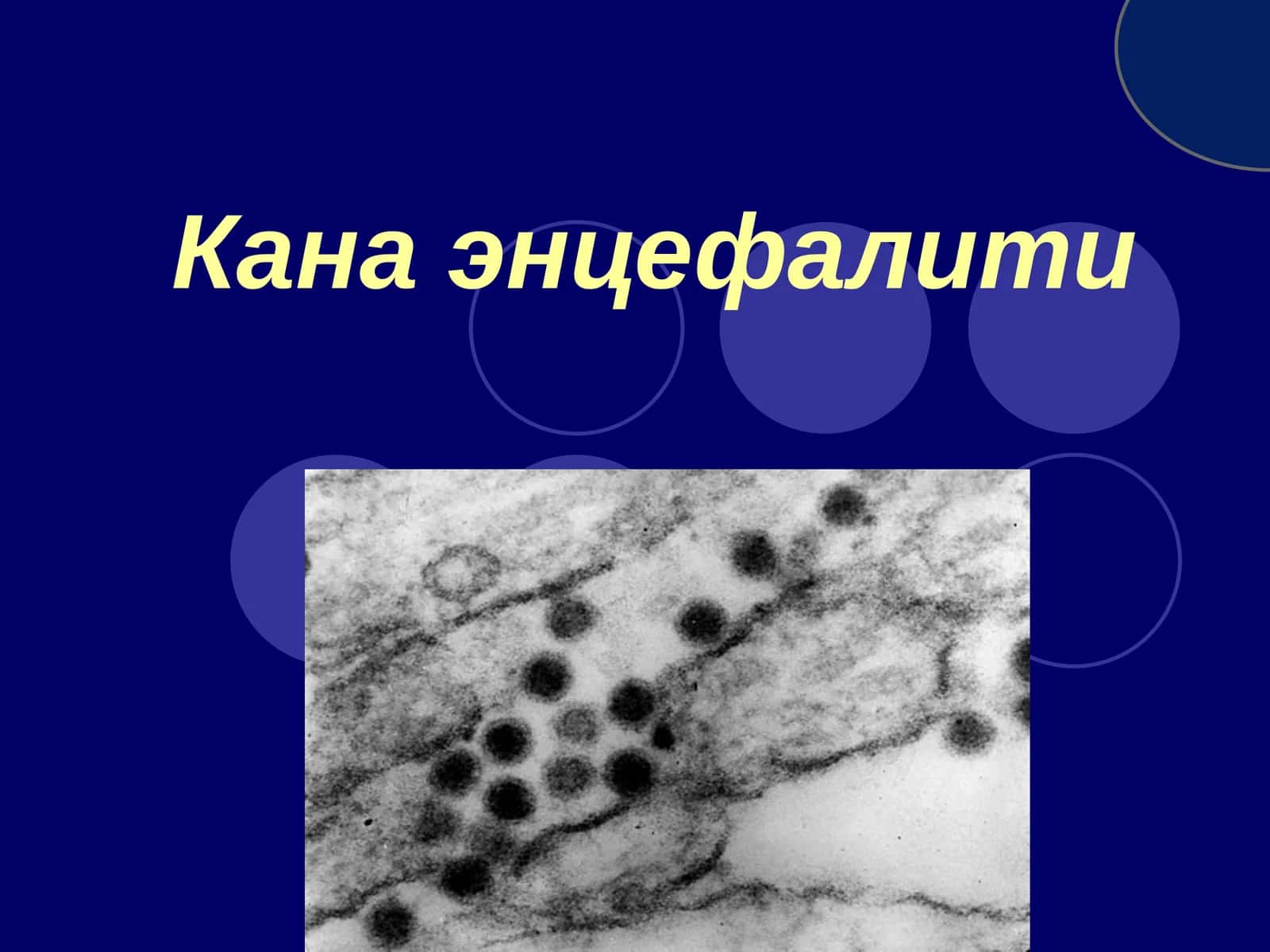 Канаэнцефалити