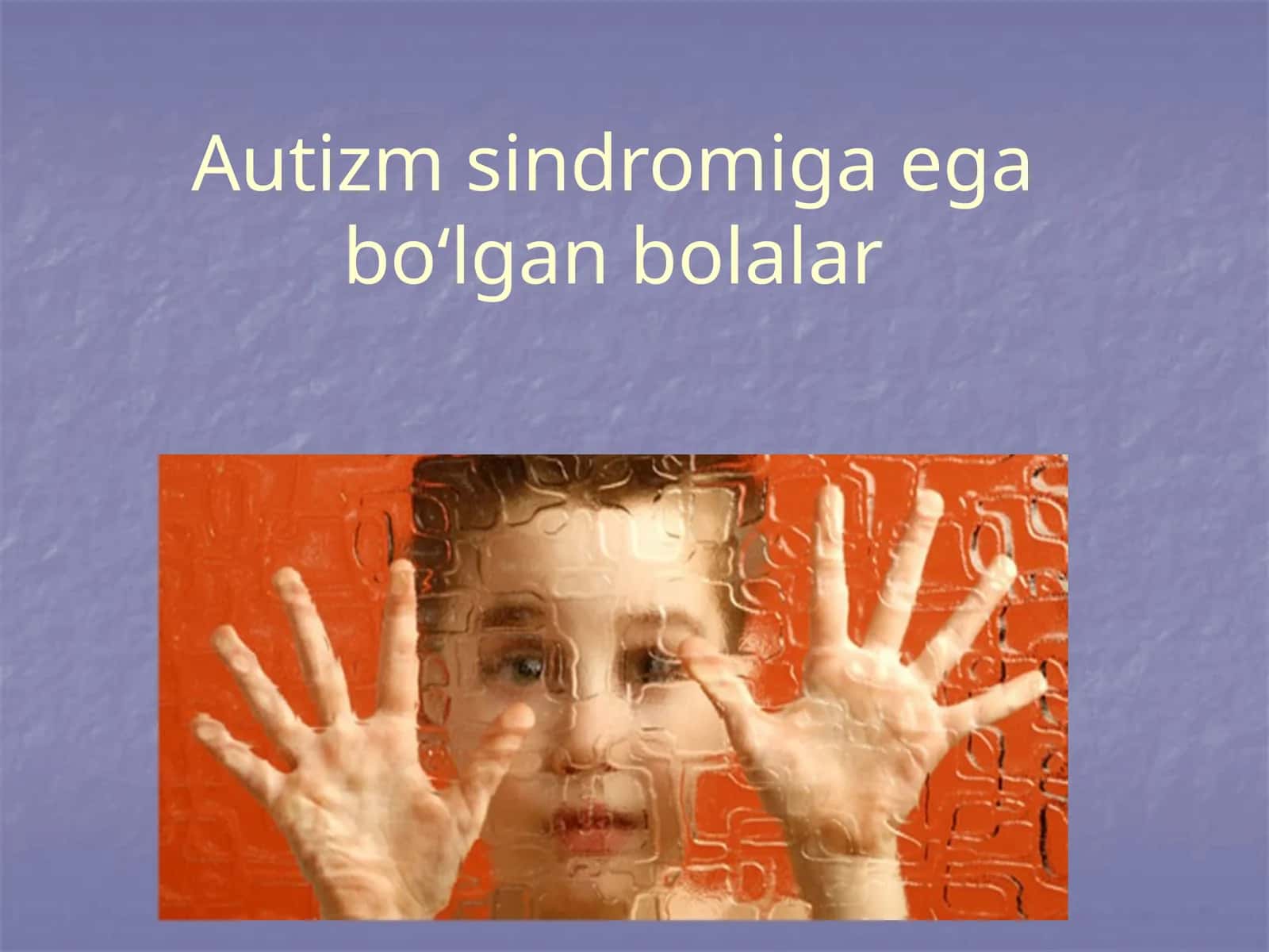 Autizm sindromiga ega bo‘lgan bolalar