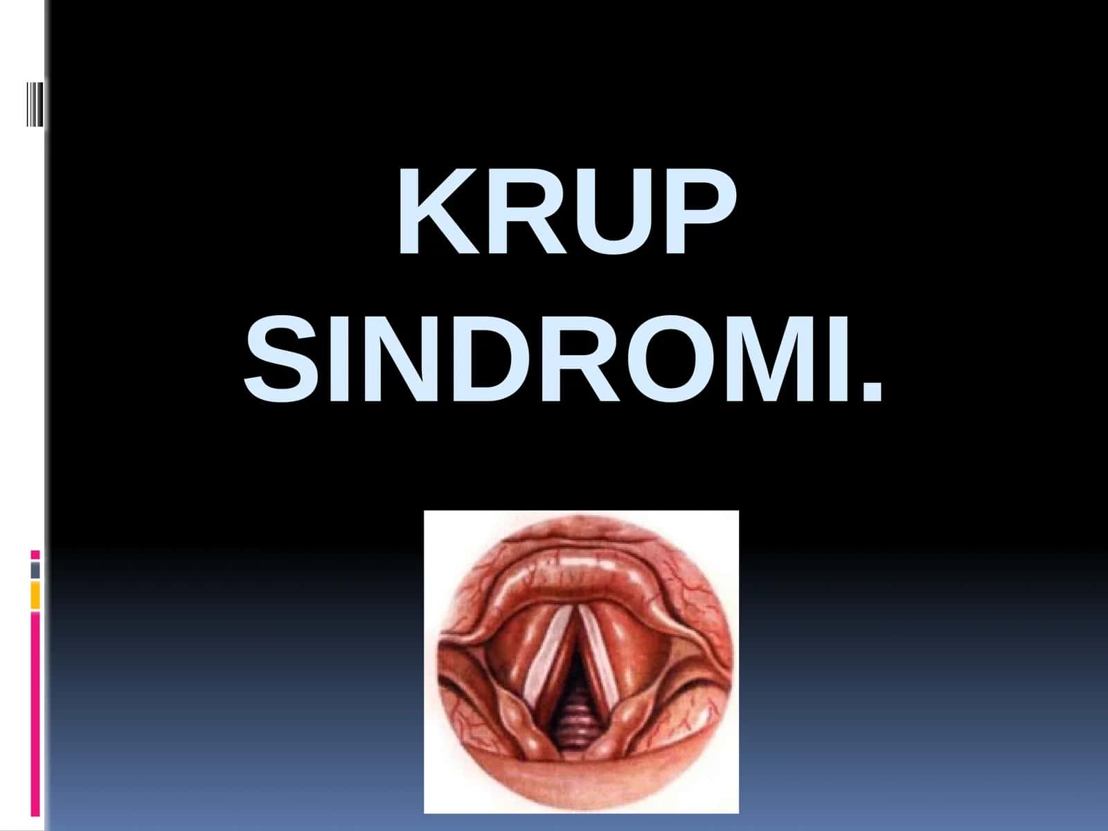 Krup sindromi