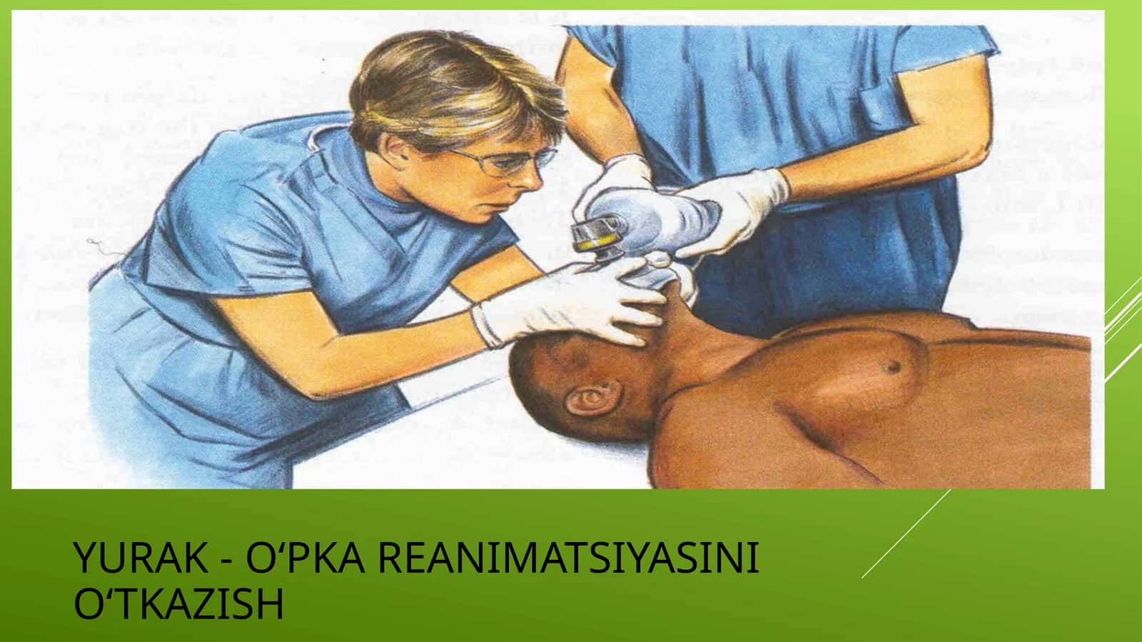 O'pka yurak ranimatsiyasini o'tkazish