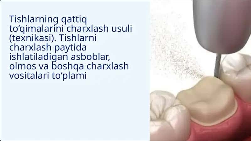 Tishlarning qattiq to‘qimalarini charхlash usuli (tехnikasi). Tishlarni charхlash paytida ishlatiladigan asboblar, olmos va boshqa charхlash vositalari to‘plami