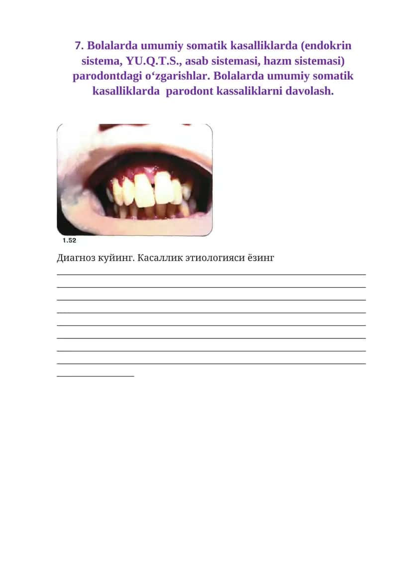 Bolalarda umumiy somatik kasalliklarda (endokrin sistema, YU.Q.T.S., asab sistemasi, hazm sistemasi) parodontdagi o‘zgarishlar