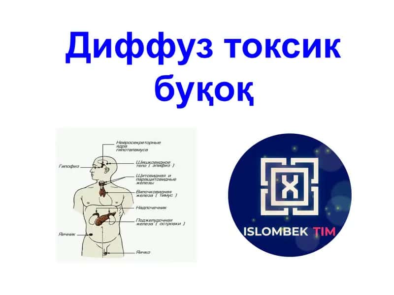 Диффуз токсик буқоқ