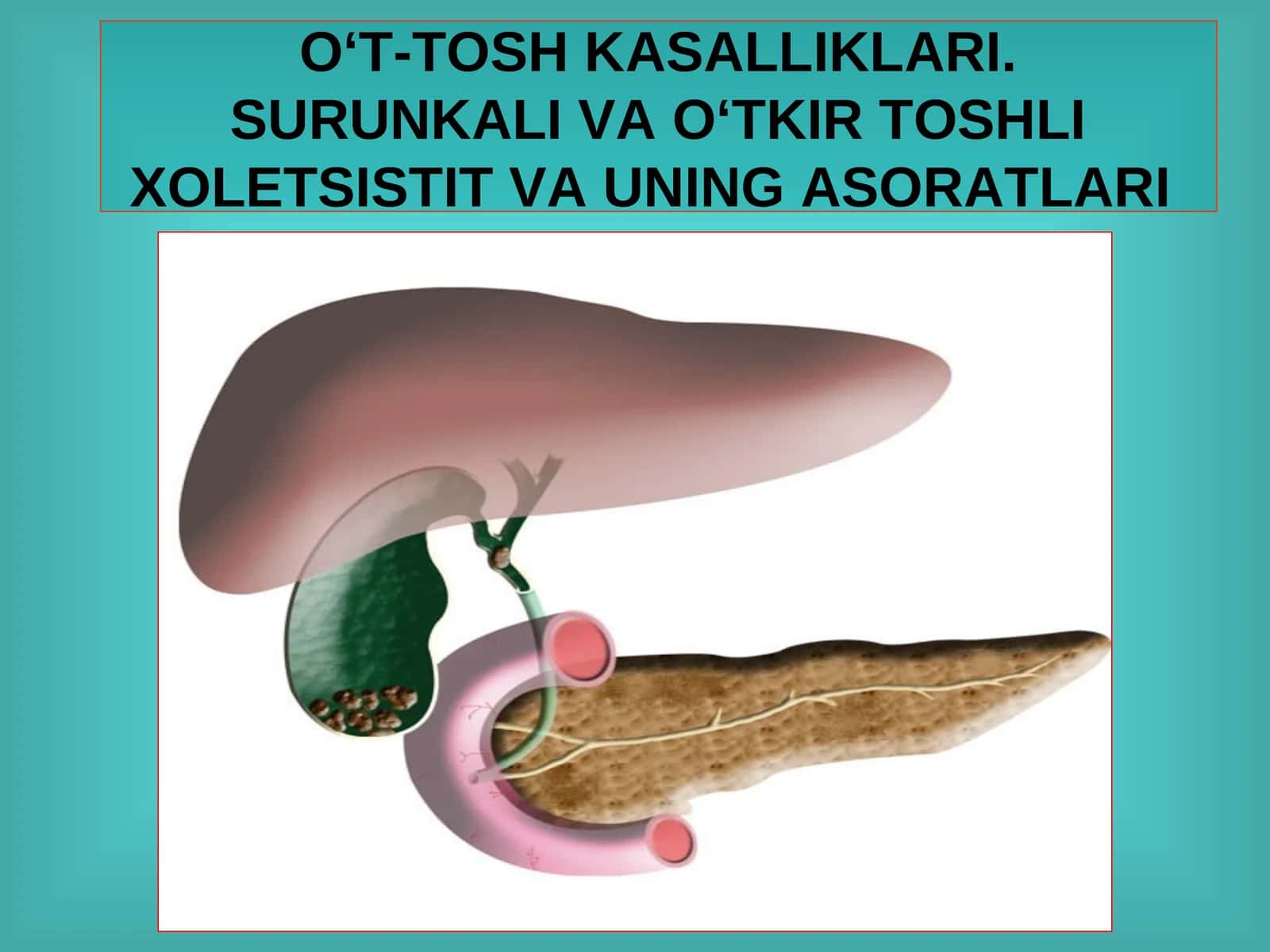 O‘T-TOSH KASALLIKLARI.SURUNKALI VA O‘TKIR TOSHLI XOLETSISTIT VA UNING ASORATLARI