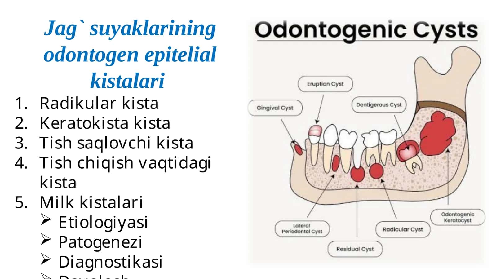 Jag` suyaklarining odontogen epitelial kistalari