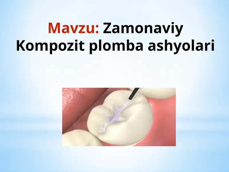 Zamonaviy Kompozit Plombaashyolari