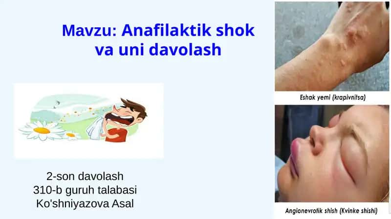 Anafilaktik shok va uni davolash