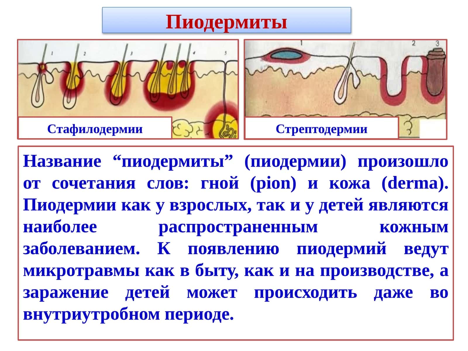 Пиодермиты