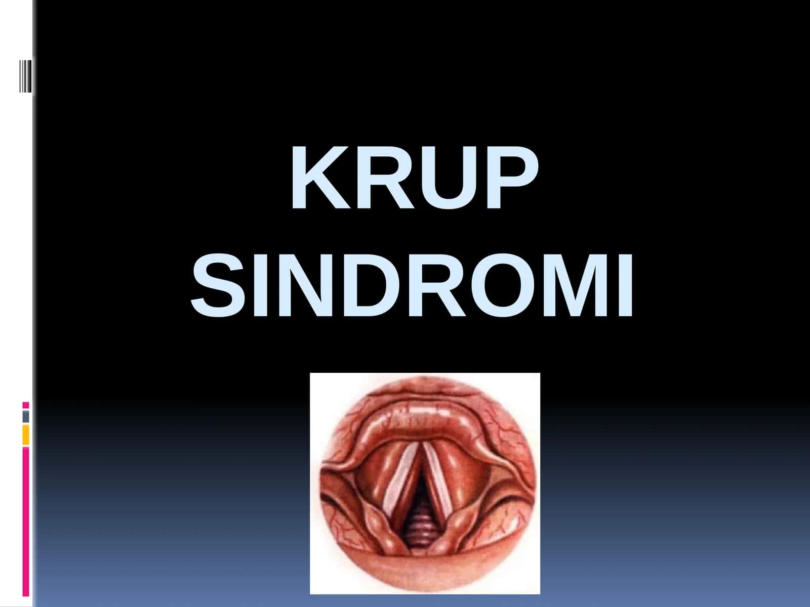 Krupsindromi