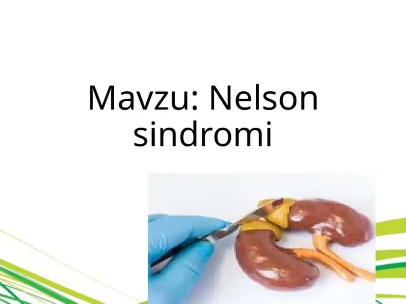 Nelson sindromi