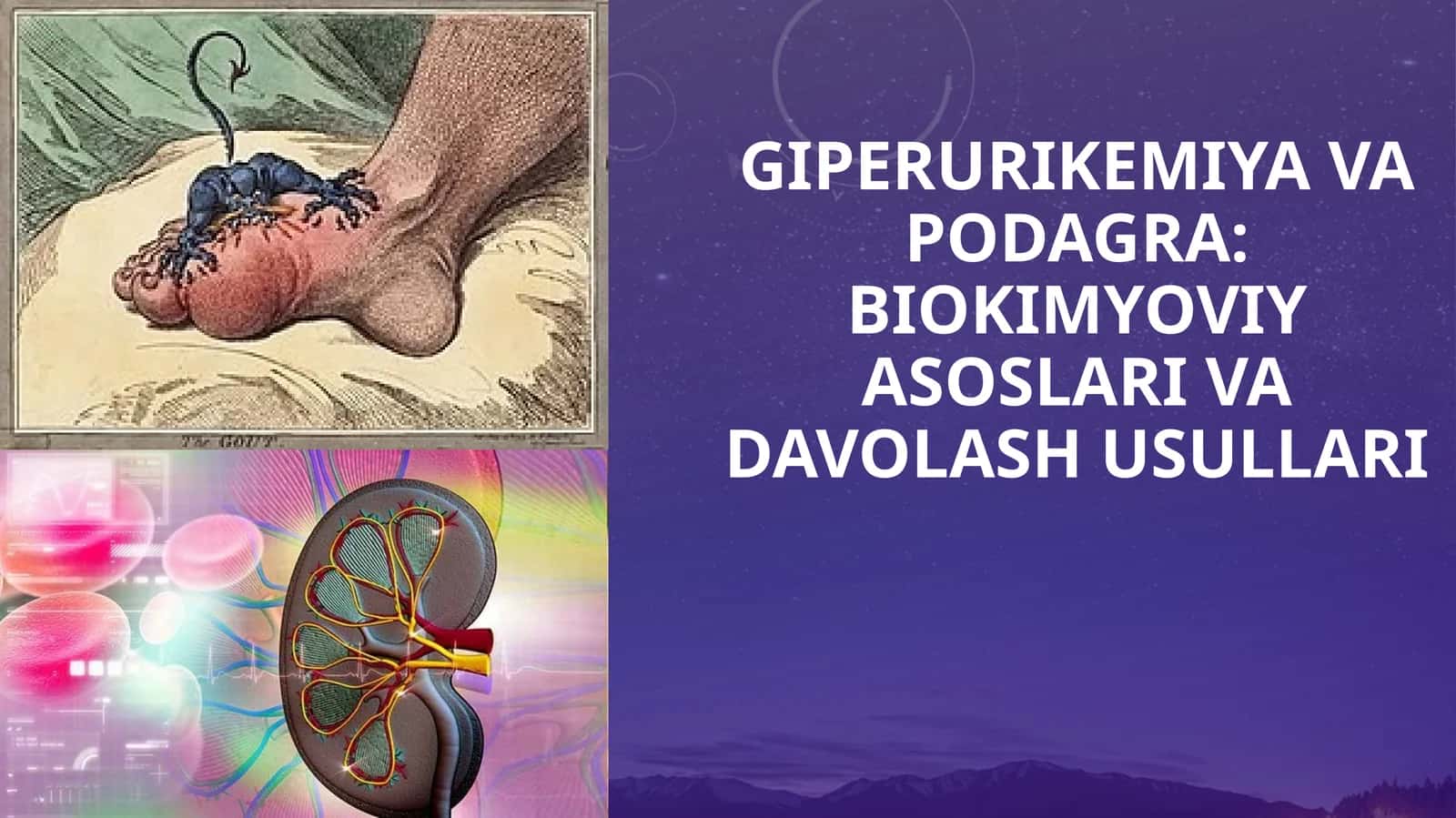 GIPERURIKEMIYA VA PODAGRA BIOKIMYOVIY ASOSLARI VA DAVOLASH USULLARI