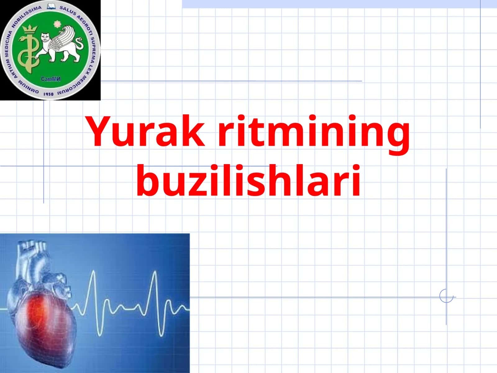 Yurak ritmining buzilishlari