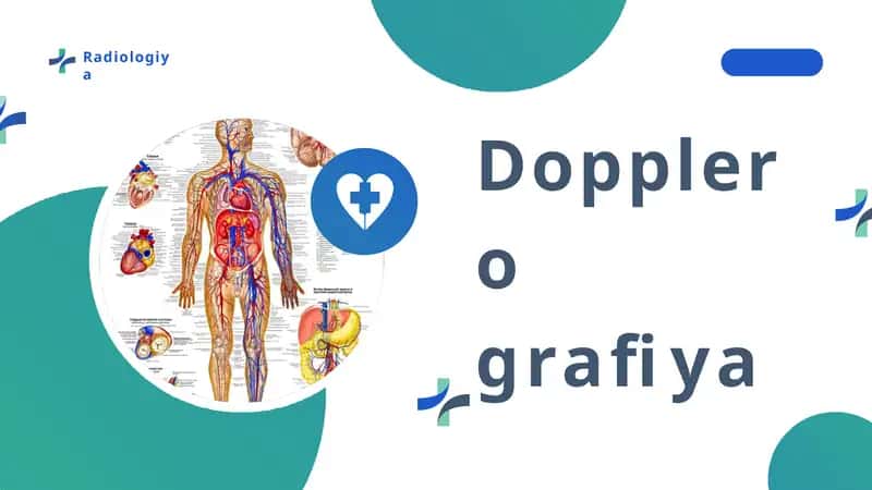 Dopplerografiya