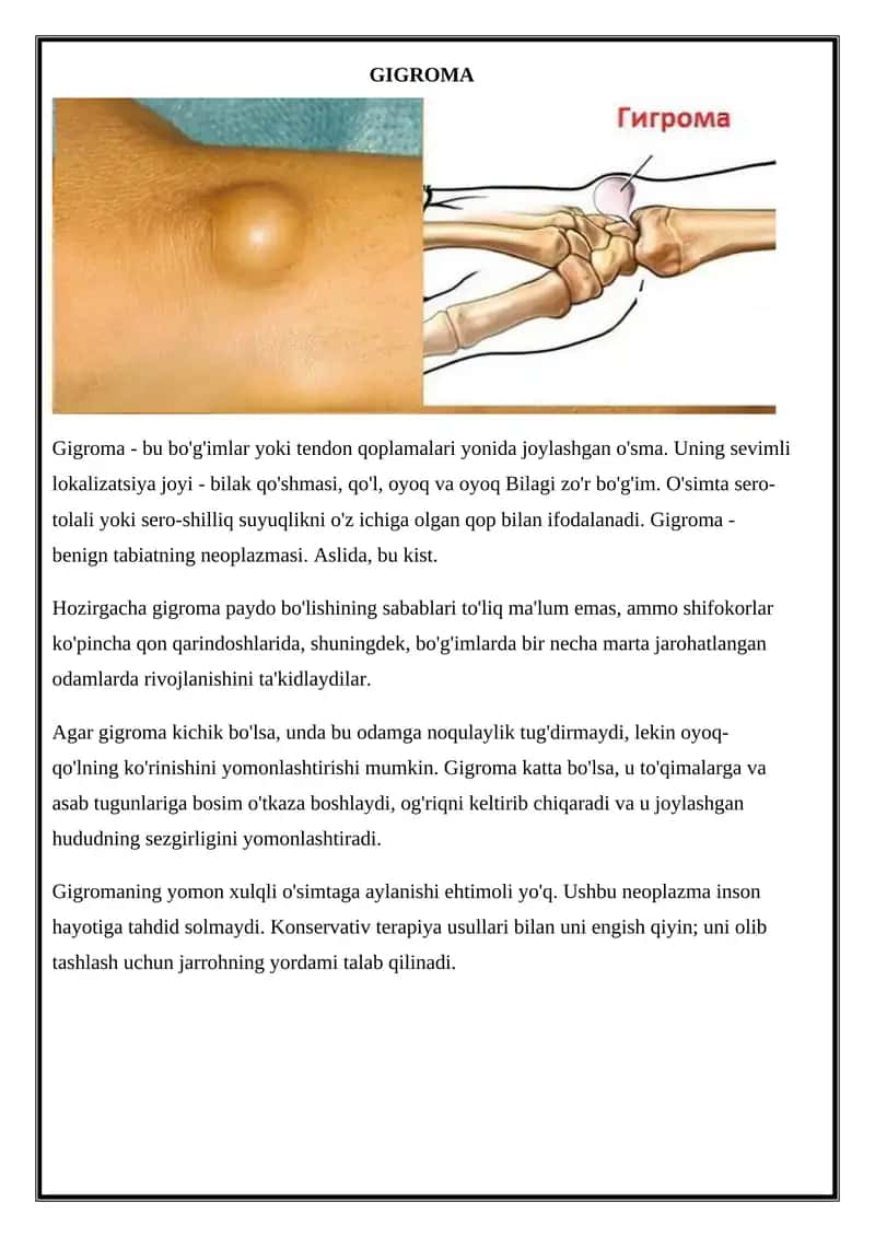 Gigroma