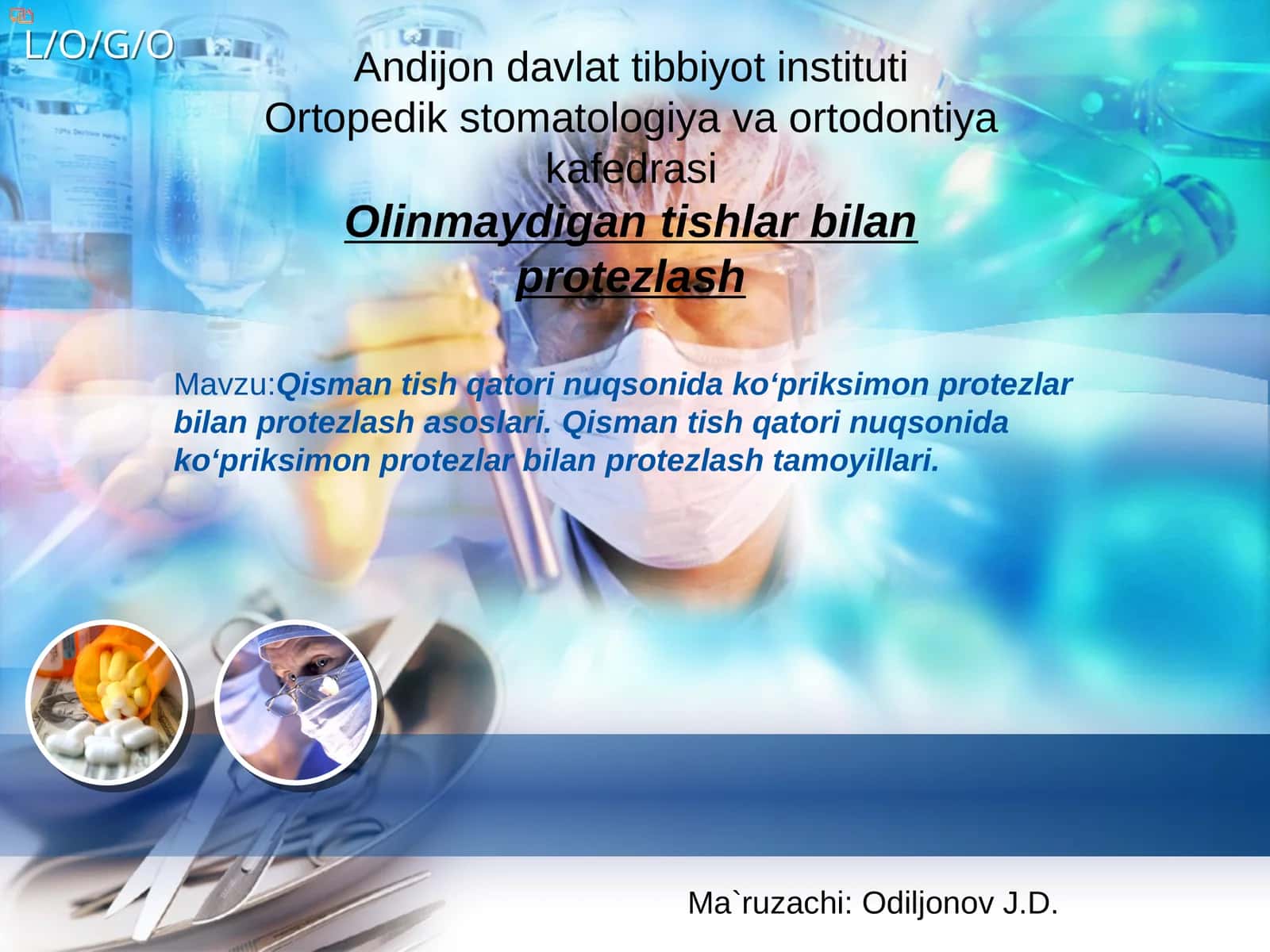 Qisman tish qatori nuqsonida ko‘priksimon protezlar bilan protezlash