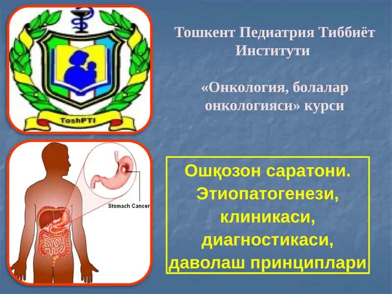 Ошқозонсаратони.Этиопатогенези,клиникаси,диагностикаси,даволашпринциплари