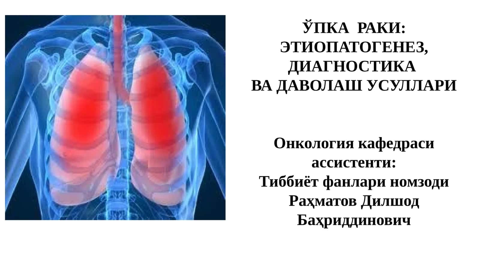 ЎПКА РАКИ