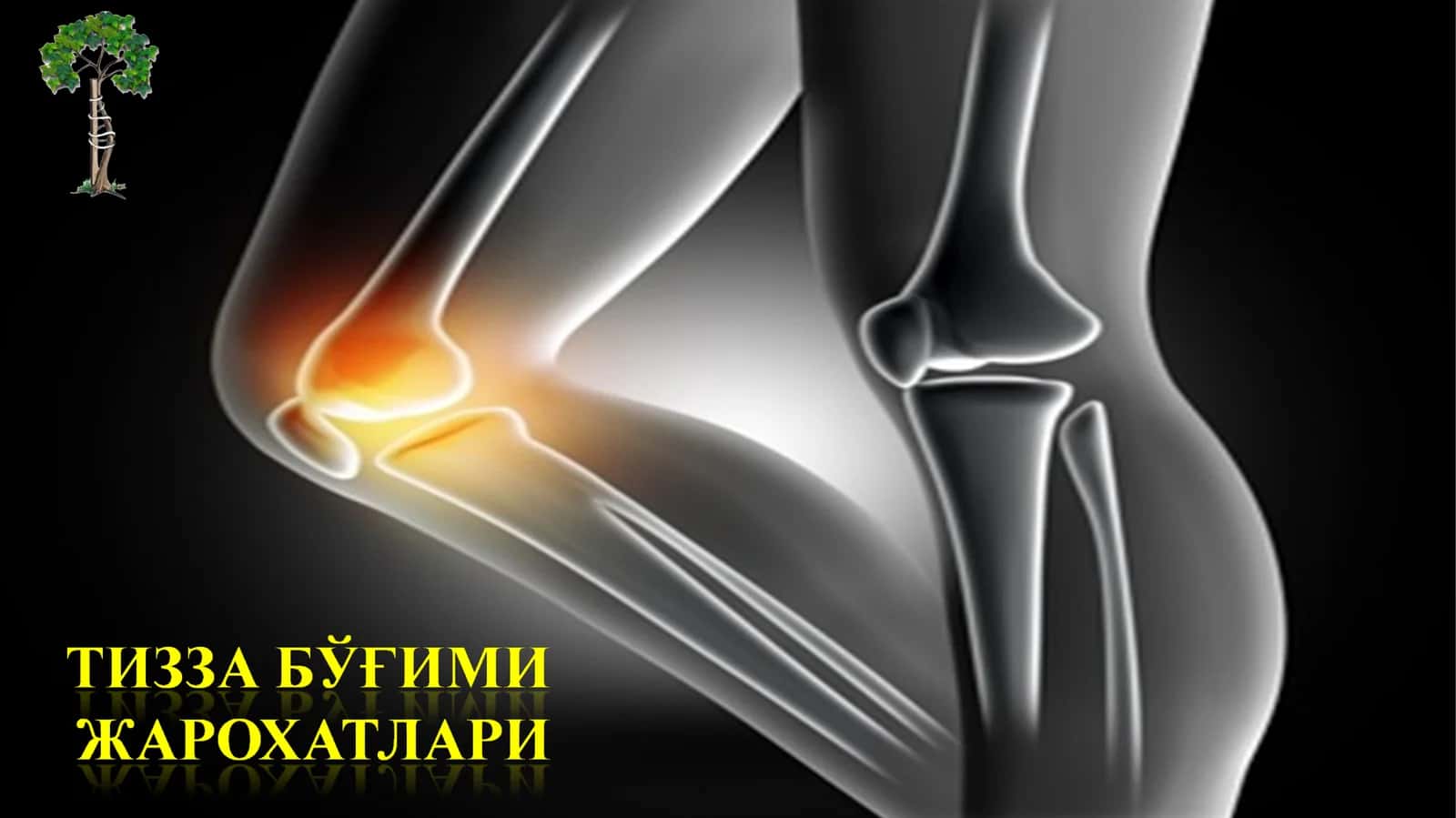 Таснифи