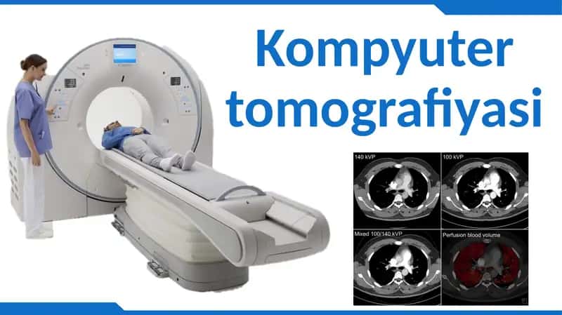 Kompyuter tomografiyasi