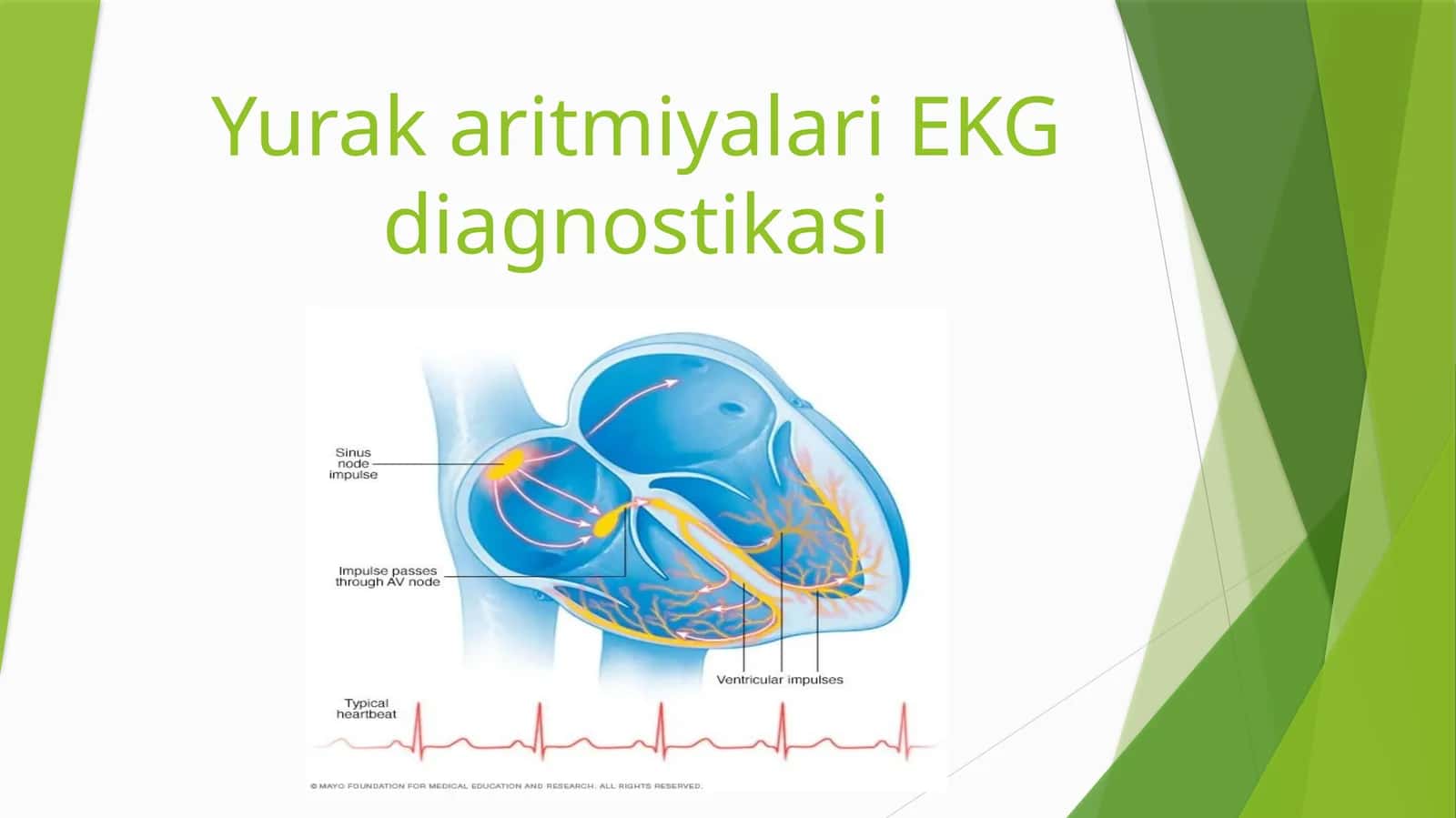 Yurak aritmiyalari EKG diagnostikasi