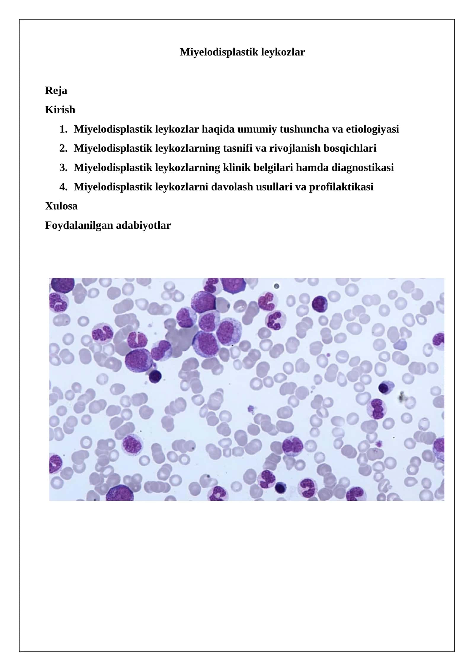 Miyelodisplastik leykozlar